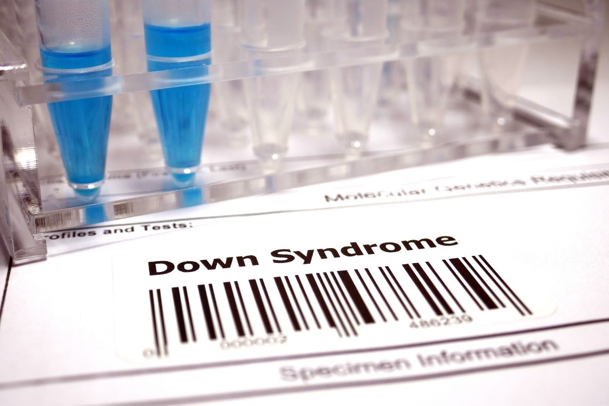 Down Sendromu Testi