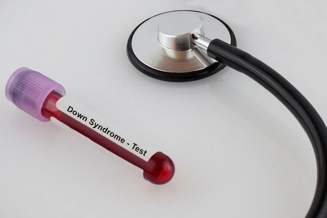 Down Sendromu Testi