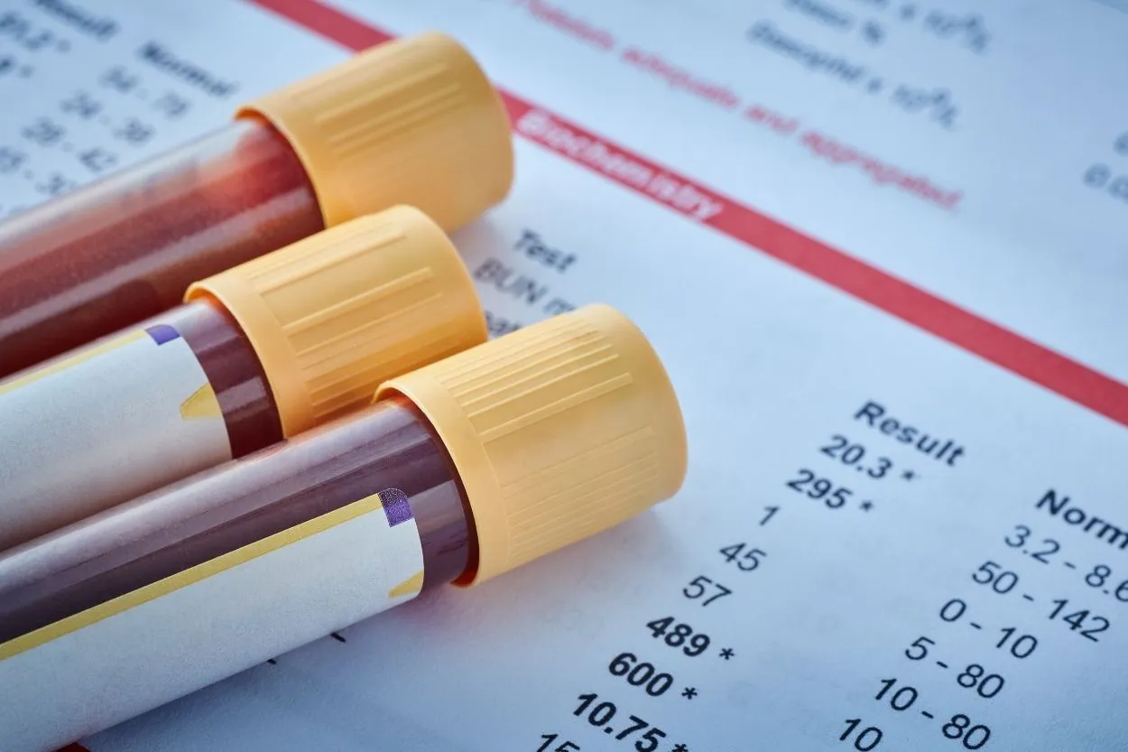 Bebeğin Cinsiyeti Kaçıncı Haftada Belli Olur