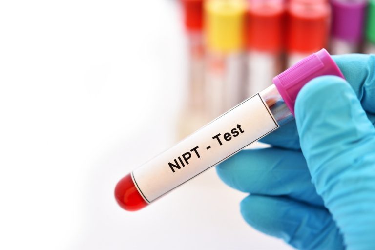 NIPT Sonuçları