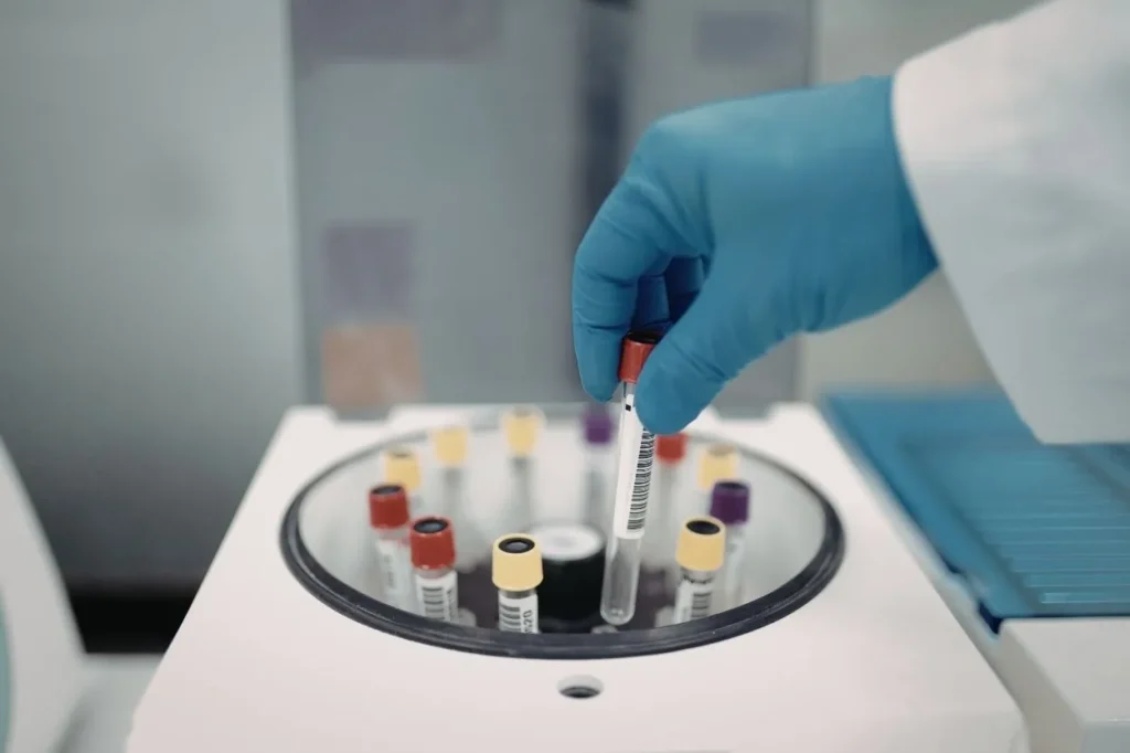 Eurofins NIPT sonucu