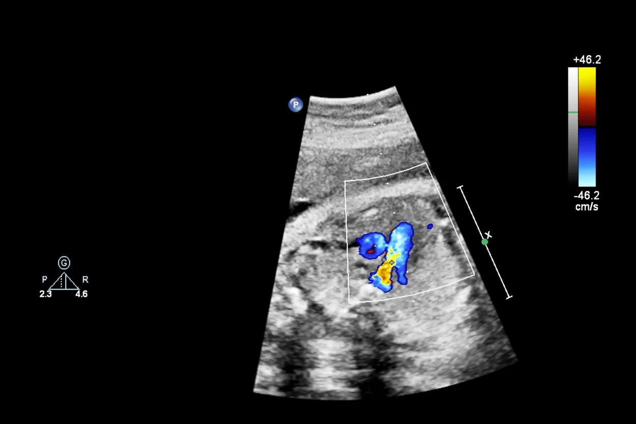 Fetal Sağlık Taraması