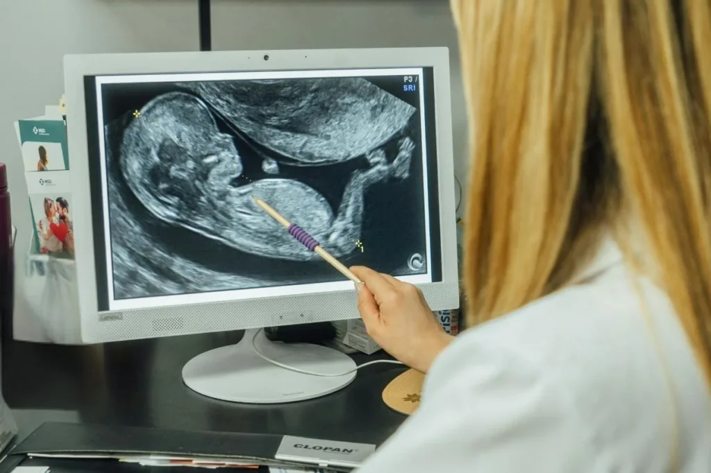 NIPT Testi Yaptıranların Yorumları